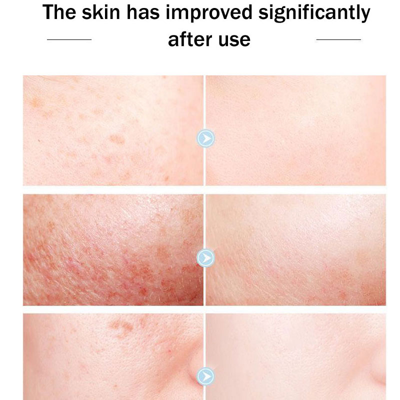 Ban Đầu Hoàng Hậu Gương Mặt Th - đánh giá và giá Skincare Queen